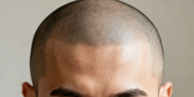 shaved head