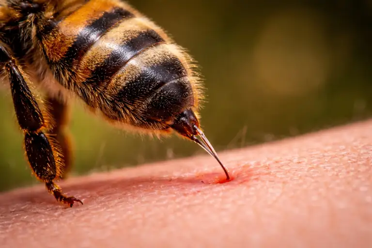 stinger