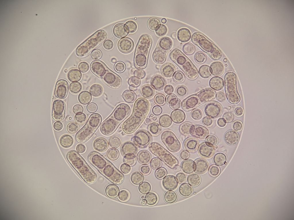 bacteria