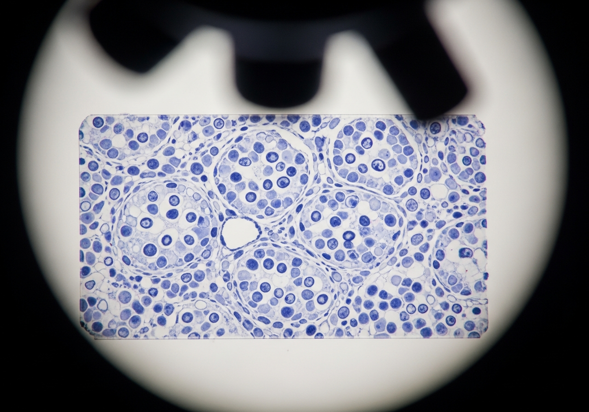 tissue